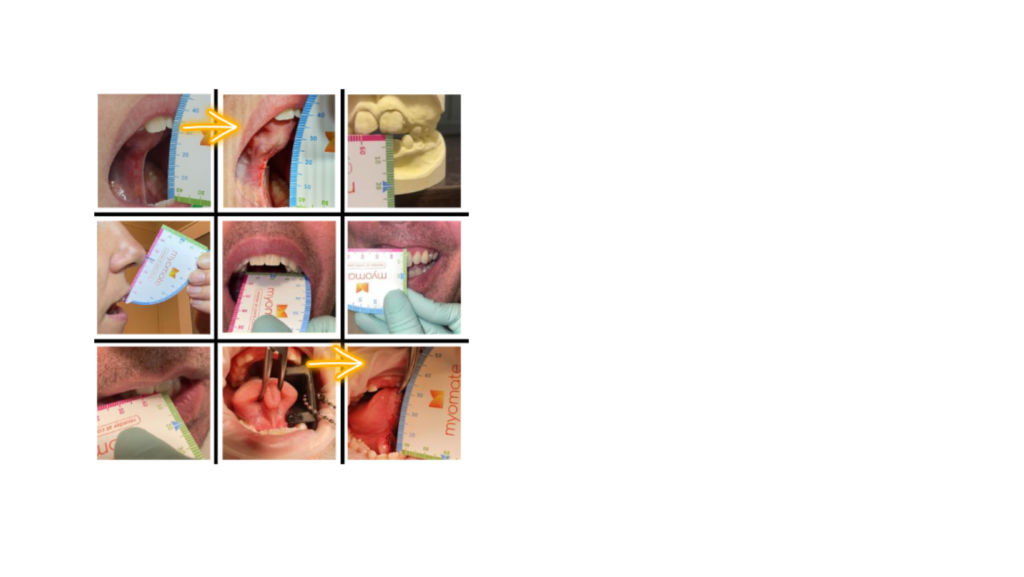 Home - Centre for Orofacial Myofunctional Therapy